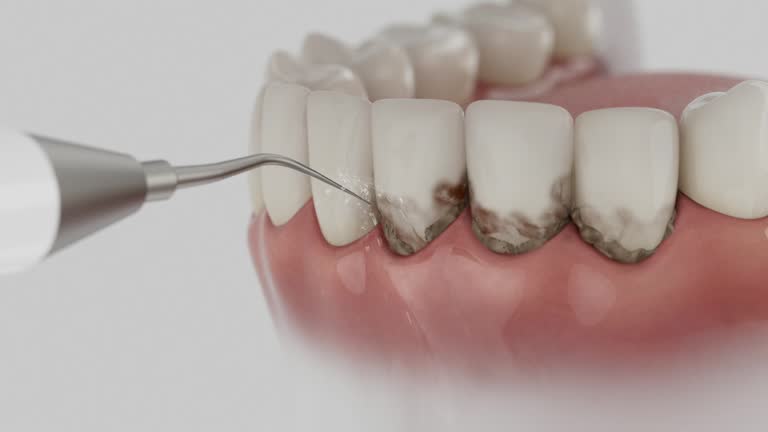 Reliable Dental Implants contractor in Newark, NY by Smile Center Dentistry